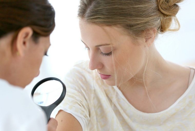 a woman being checked by a dermatologist